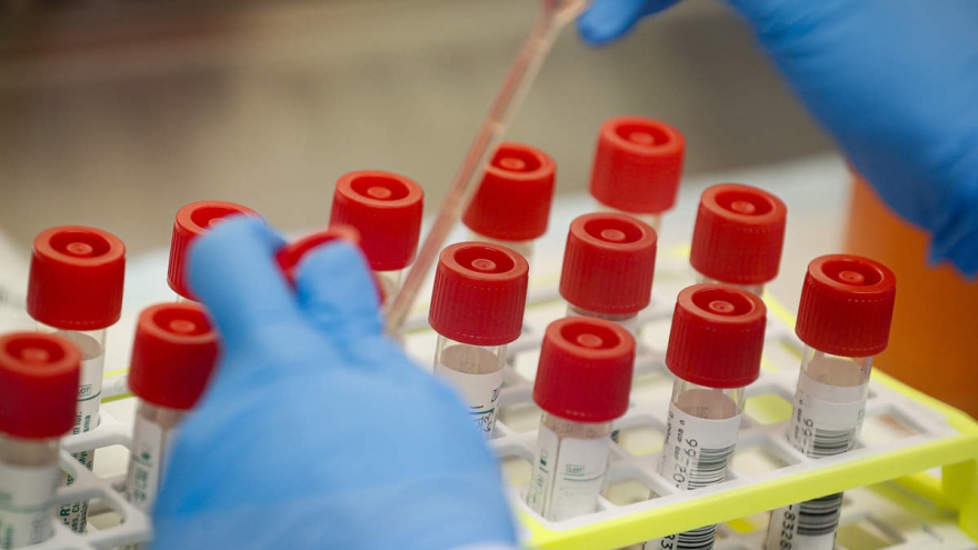 Mỹ thu hồi 12.000 bộ xét nghiệm SARS-CoV-2 do nhiễm khuẩn